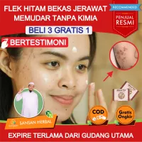 Detail Gambar Move On Terbaru Masker Alami Untuk Menghilangkan Bekas Jerawat Nomer 2