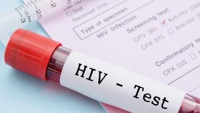 Detail Gambar Orang Kena Hiv Aids Nomer 51