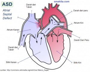 Detail Gambar Organ Jantung Manusia Nomer 52