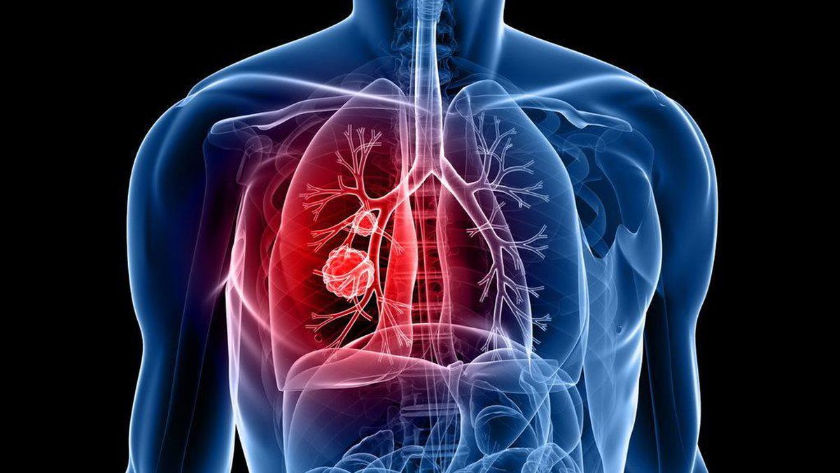 Detail Gambar Organ Pernapasan Gerak Hewan Dan Manusia Nomer 16