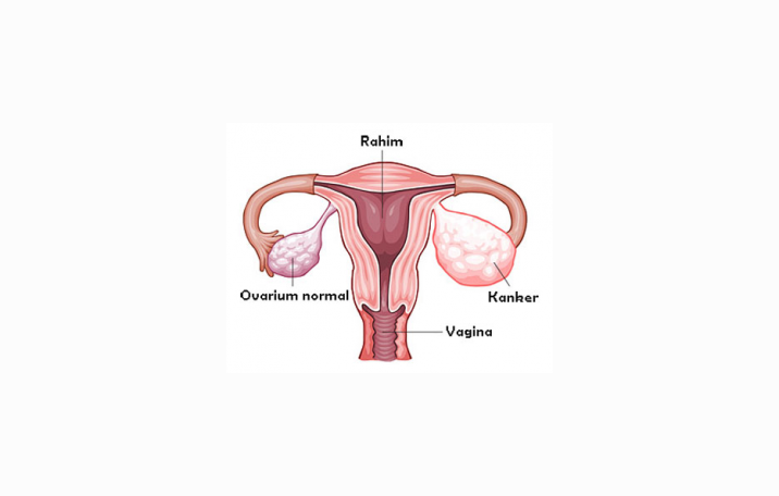 Detail Gambar Ovarium Dan Fungsinya Nomer 16
