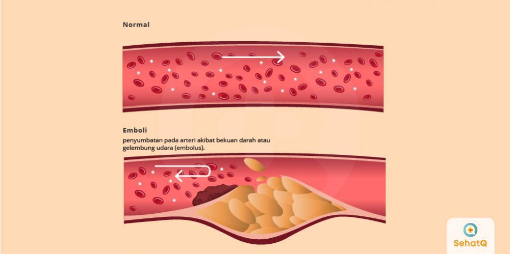 Detail Gambar Partikel Pembuluh Darah Nomer 3