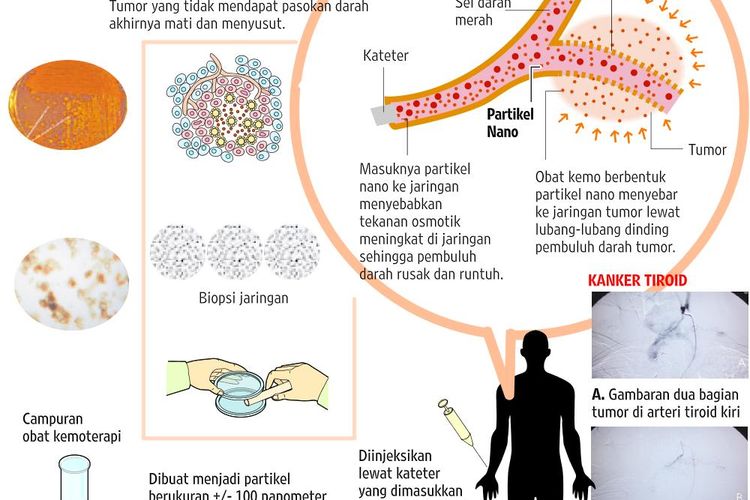 Detail Gambar Partikel Pembuluh Darah Nomer 10