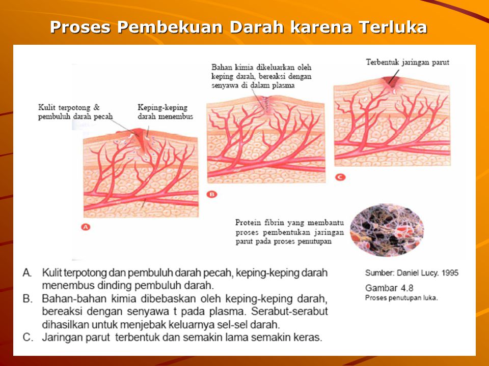 Detail Gambar Pembuluh Darah Manusia Yang Terluka Nomer 21