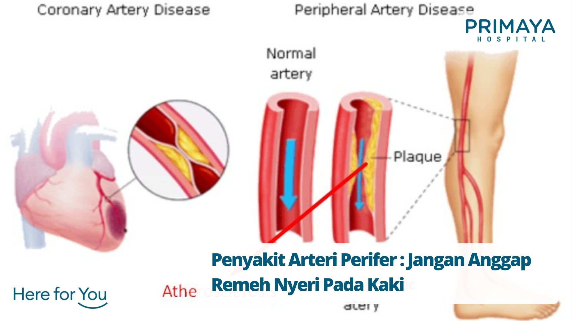 Detail Gambar Pembuluh Darah Manusia Yang Terluka Nomer 50