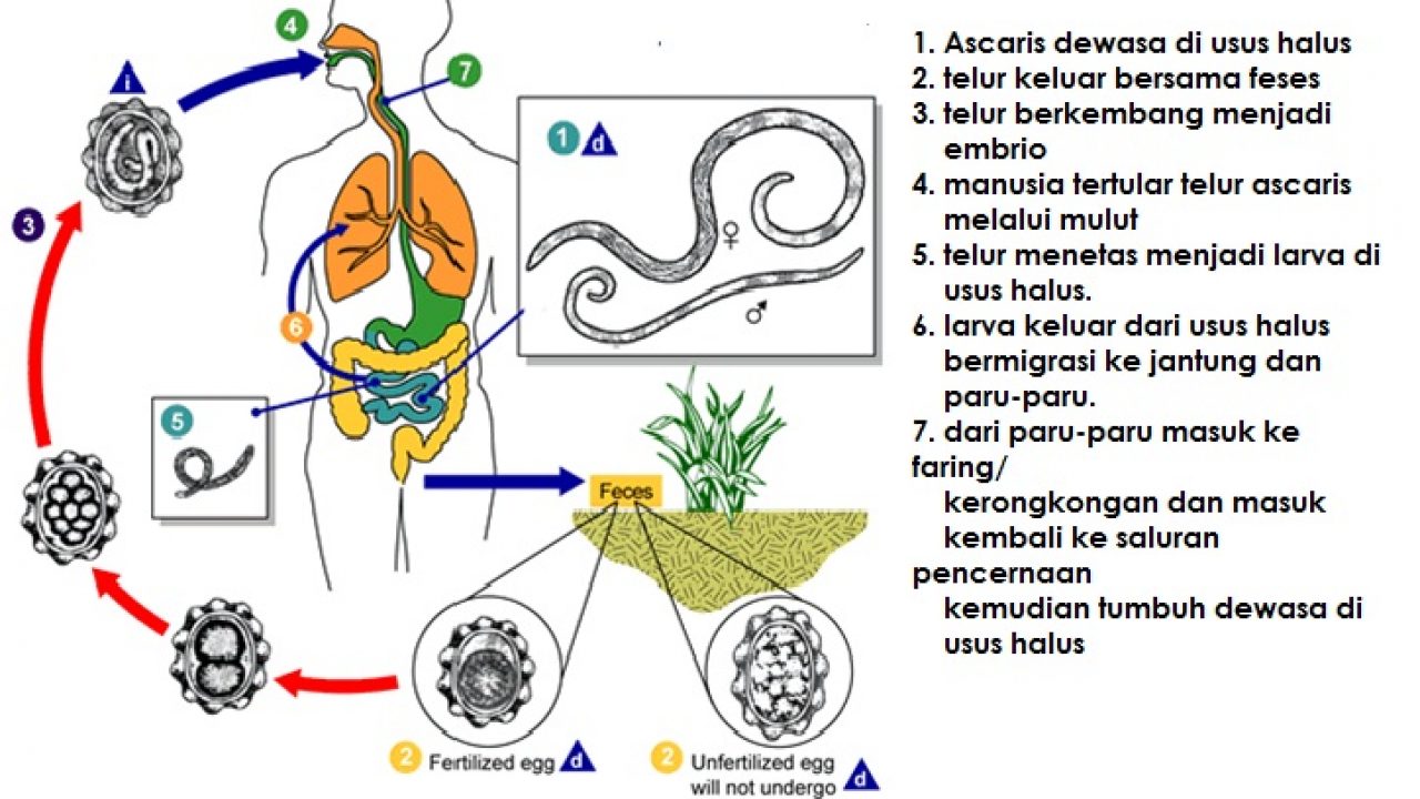 Detail Gambar Penyakit Ascariasis Nomer 22