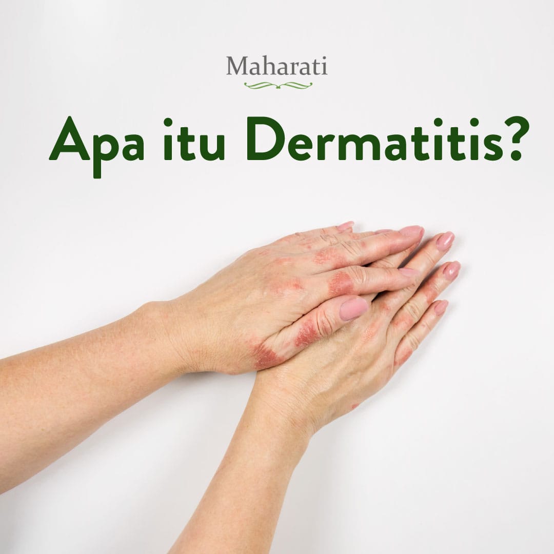 Detail Gambar Penyakit Dermatitis Atopik Nomer 50