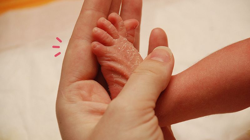 Detail Gambar Penyakit Dermatitis Kontak Nomer 34