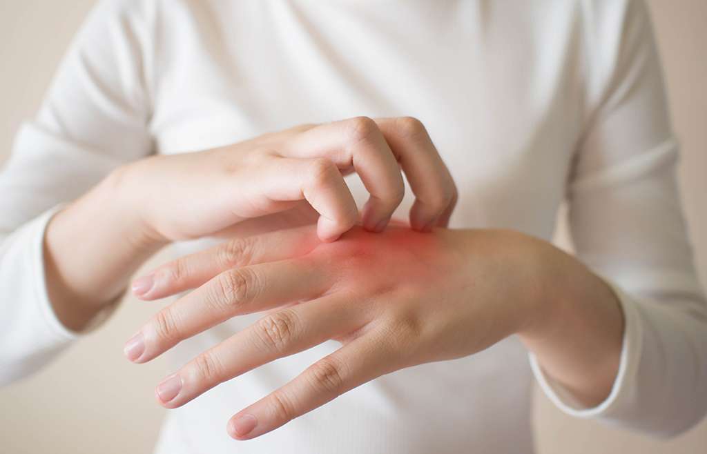 Detail Gambar Penyakit Dermatitis Kontak Nomer 40