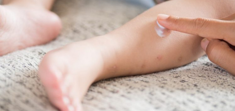 Detail Gambar Penyakit Dermatitis Kontak Nomer 43