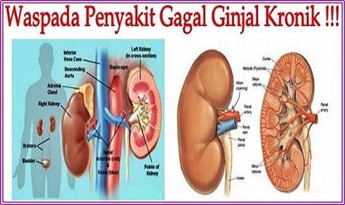 Detail Gambar Penyakit Gagal Ginjal Nomer 30