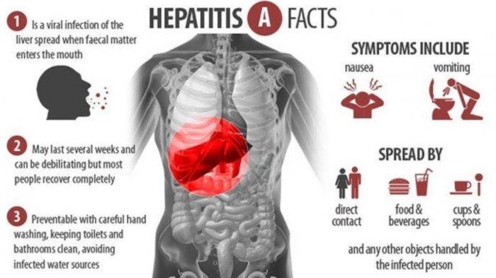 Detail Gambar Penyakit Hepatitis Nomer 13