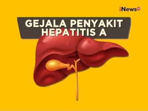 Detail Gambar Penyakit Hepatitis Nomer 16