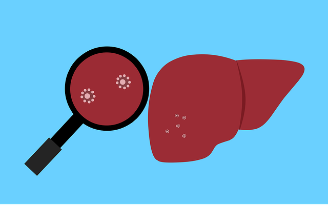 Detail Gambar Penyakit Hepatitis Nomer 19