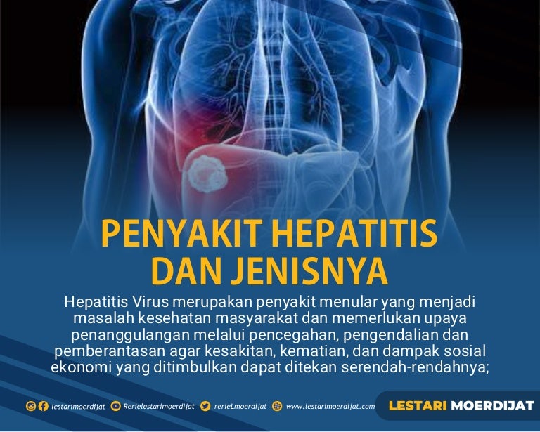 Detail Gambar Penyakit Hepatitis Nomer 20