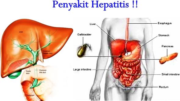 Detail Gambar Penyakit Hepatitis Nomer 31