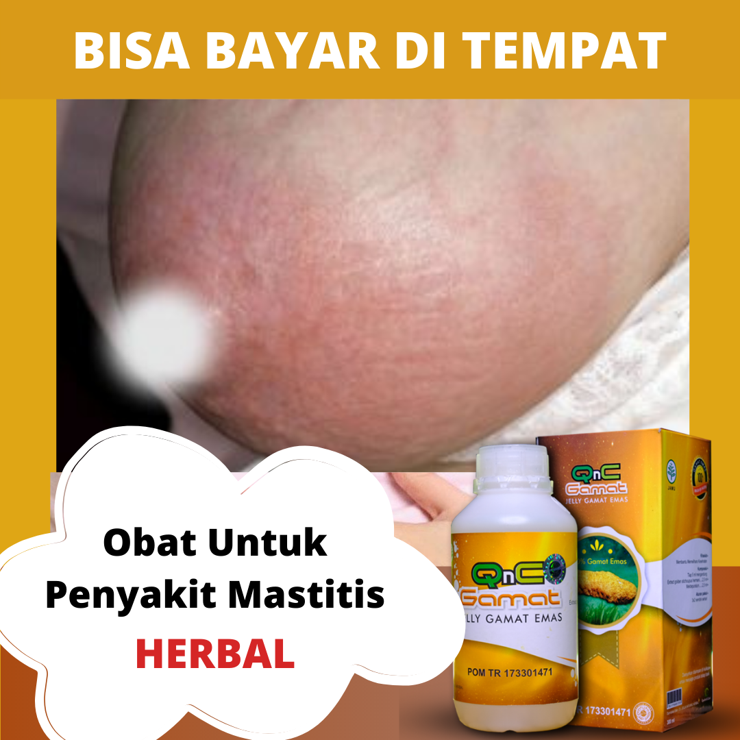 Detail Gambar Penyakit Mastitis Nomer 45