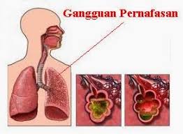 Detail Gambar Pernapasan Manusia Serta Penyakit Nomer 17