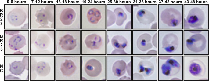 Detail Gambar Plasmodium Falciparum Nomer 9