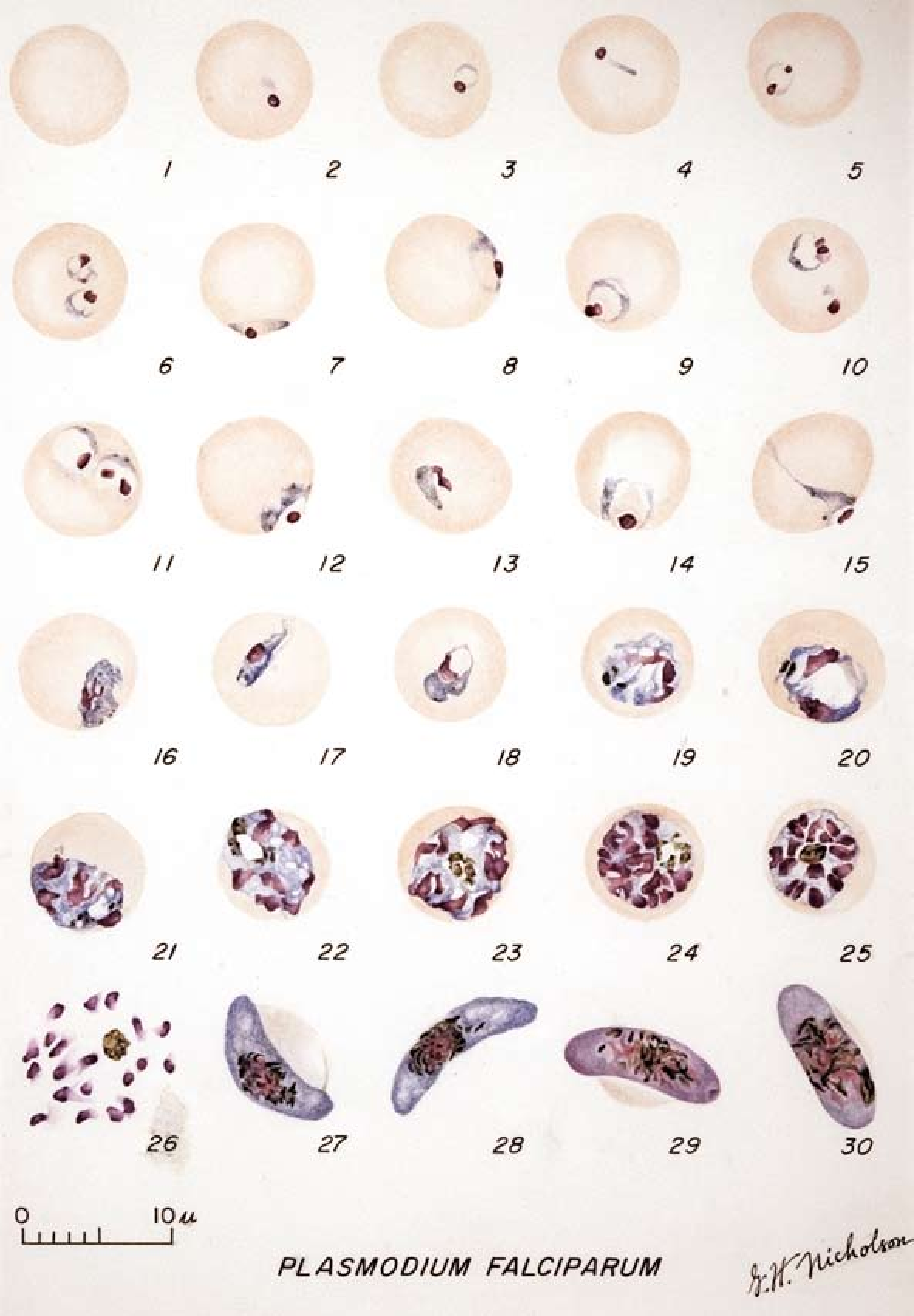 Detail Gambar Plasmodium Falciparum Nomer 8