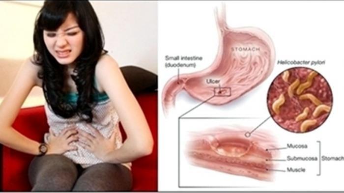 Detail Gambar Posisi Lambung Pada Tubuh Manusia Nomer 16