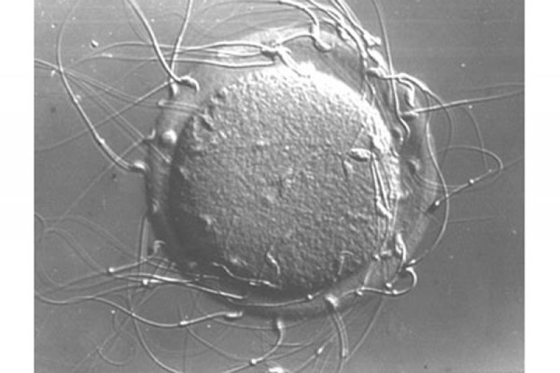 Detail Gambar Sel Sperma Nomer 50