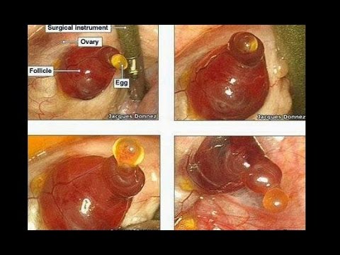 Detail Gambar Sel Telur Manusia Nomer 12