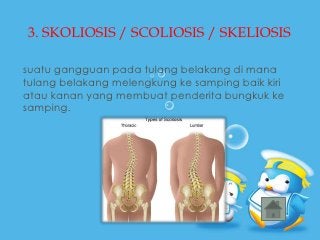 Detail Gambar Sendi Untuk Power Point Nomer 13