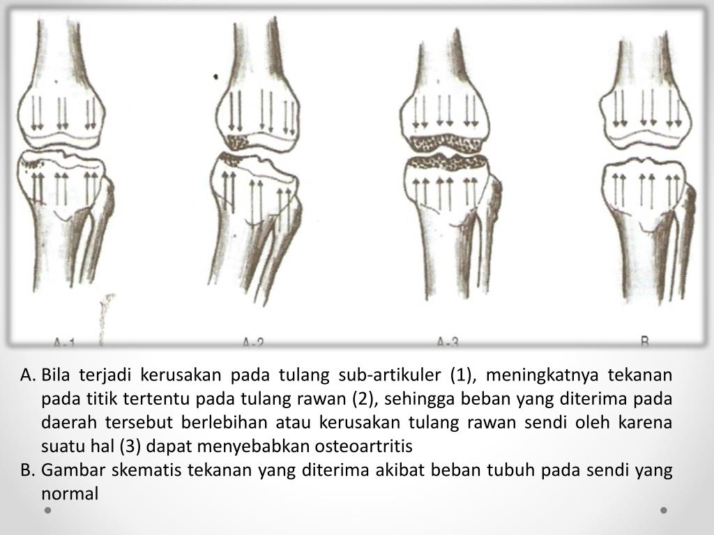 Detail Gambar Sendi Untuk Power Point Nomer 40