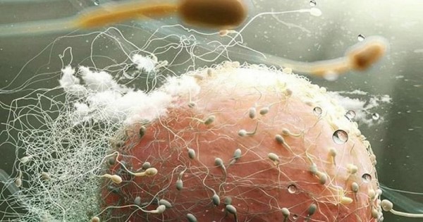 Detail Gambar Sperma Tidak Sehat Nomer 28