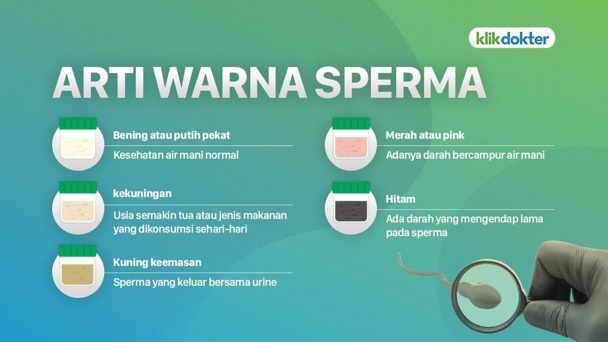 Detail Gambar Sperma Yang Sehat Nomer 3