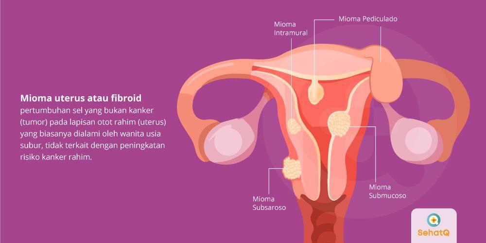 Detail Gambar Struktur Manusia Saat Menstruasi Nomer 22