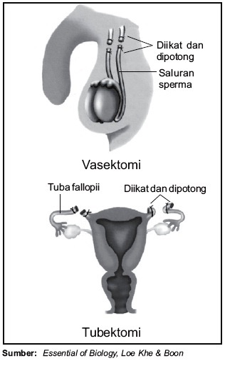 Detail Gambar Teknologi Sistem Penapasan Nomer 46