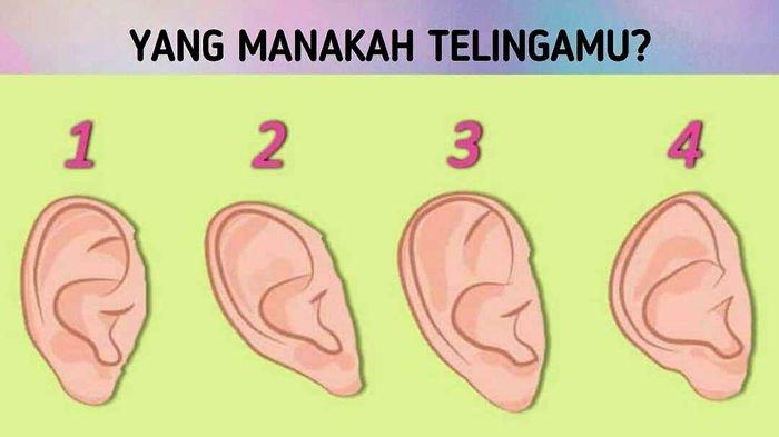 Detail Gambar Telinga Manusia Nomer 35