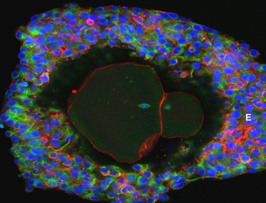 Detail Gambar Telur Manusia Nomer 29