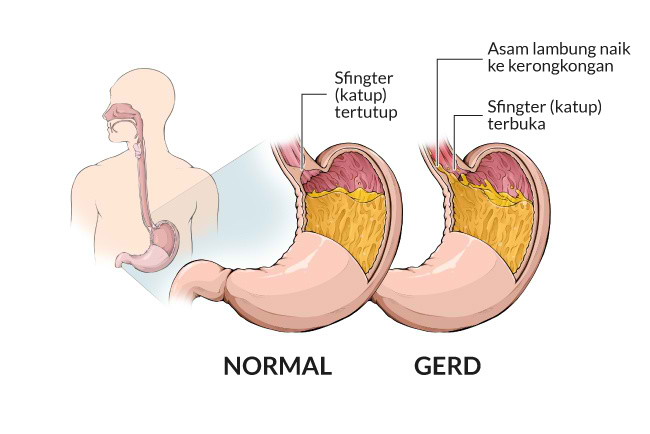 Detail Gambar Terapi Anatomi Penyakit Manusia Nomer 13