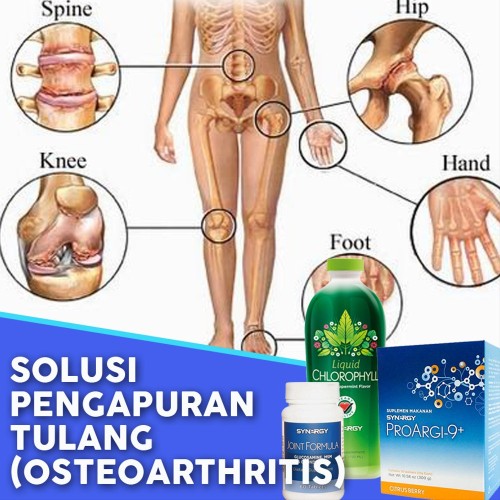 Detail Gambar Terapi Penyakit Manusia Nomer 12