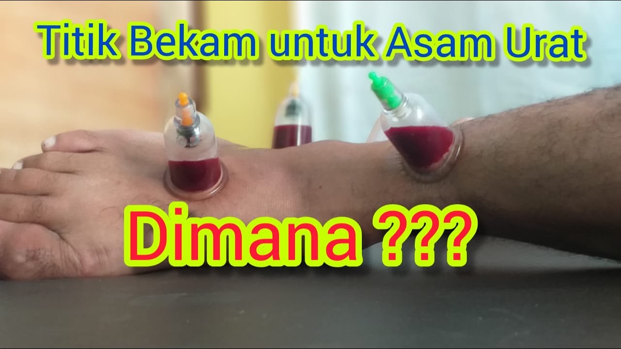 Detail Gambar Titik Bekam Nomer 35