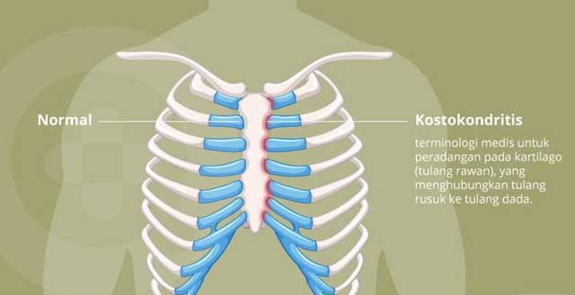 Detail Gambar Tulang Dada Manusia Nomer 31