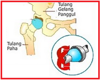 Detail Gambar Tulang Lengan Manusia Nomer 38