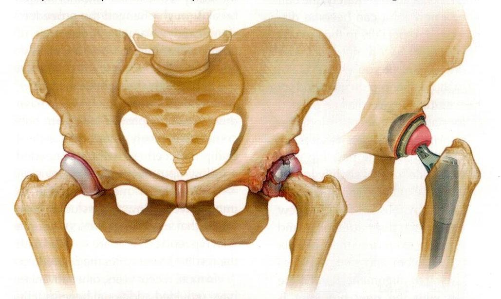 Detail Gambar Tulang Pelvis Dan Penjelasan Nomer 21