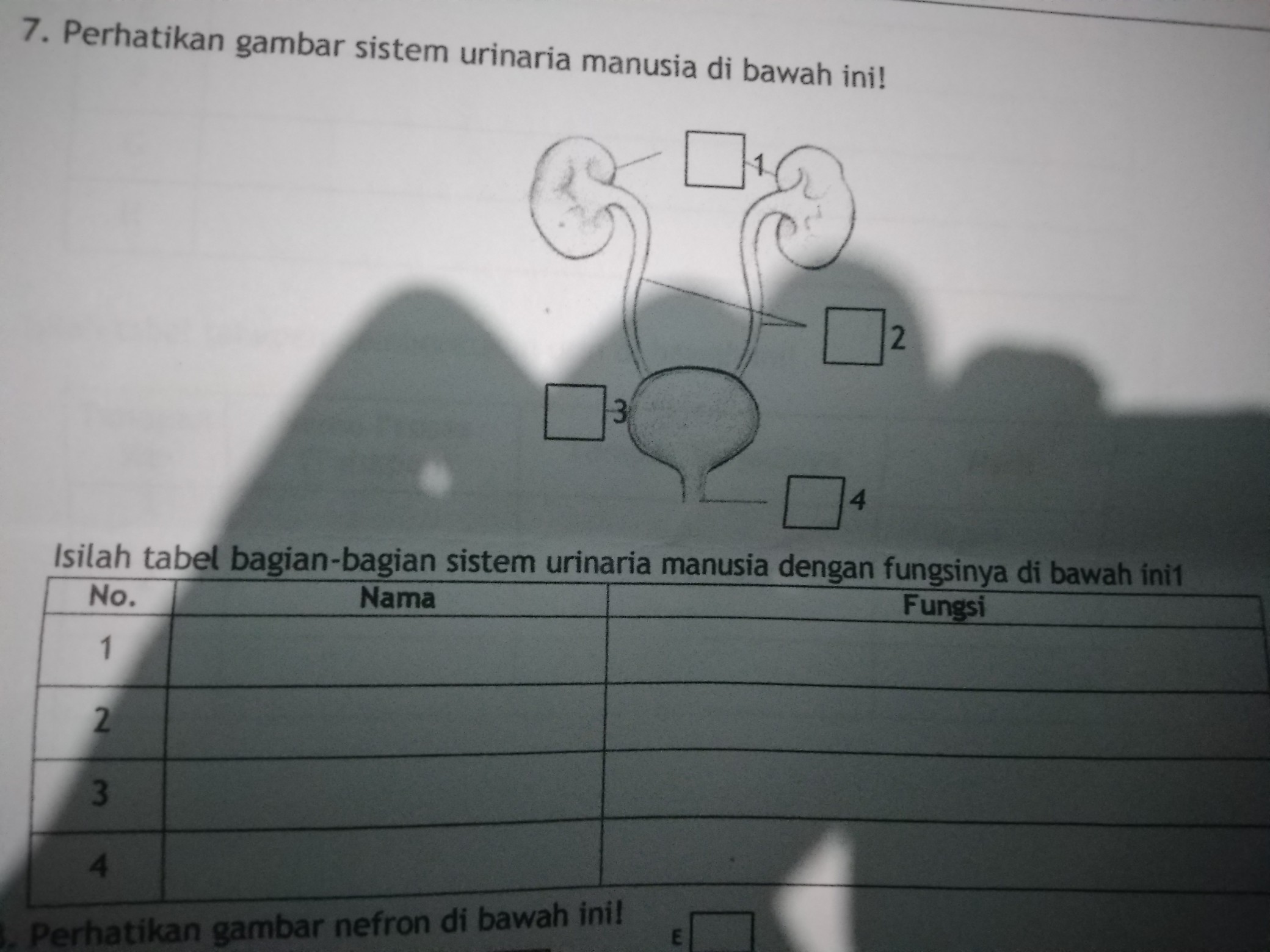 Detail Gambar Urinaria Dan Fungsinya Nomer 42