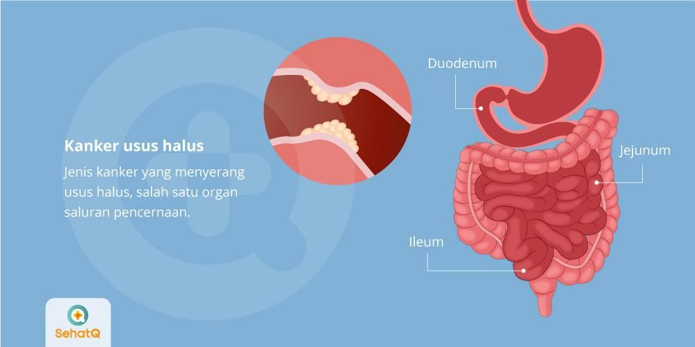 Detail Gambar Usus Penyerapan Nomer 35