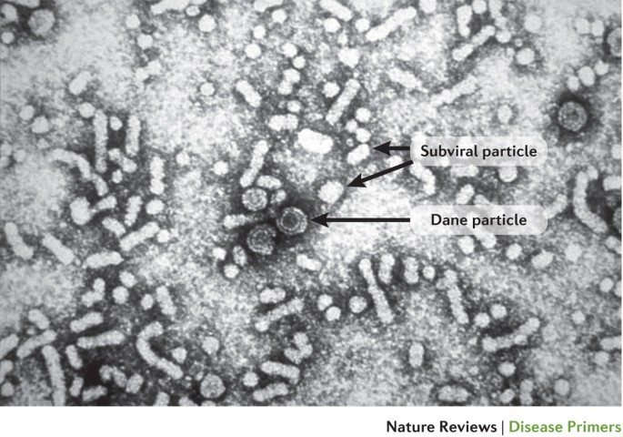 Detail Gambar Virus Hepatitis B Nomer 10