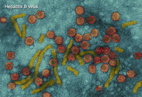 Detail Gambar Virus Hepatitis B Nomer 12