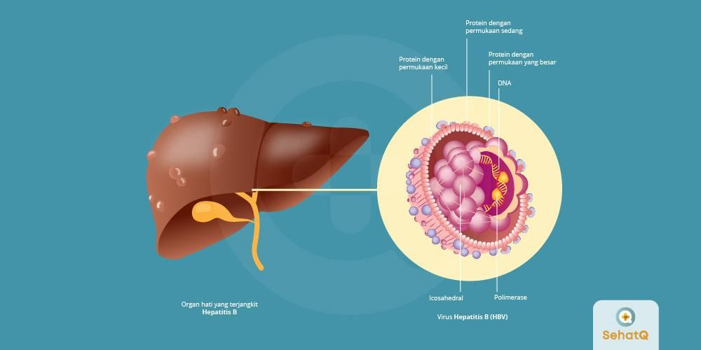 Detail Gambar Virus Hepatitis B Nomer 36