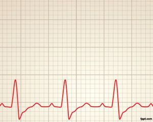Detail Heartbeat Powerpoint Template Free Nomer 5