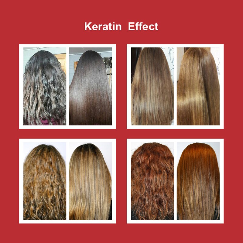 Detail Infus Keratin Adalah Nomer 15