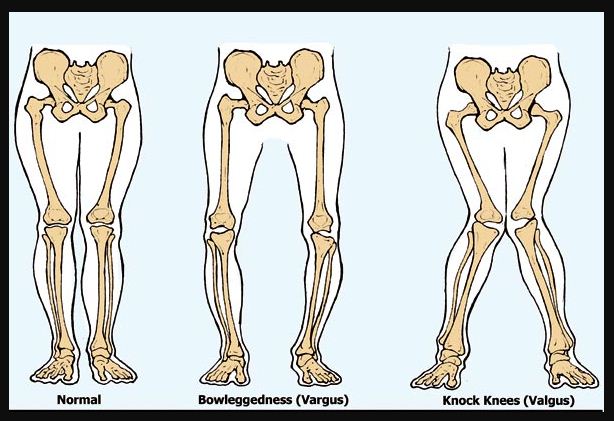 Detail Jenis Jenis Tulang Pada Manusia Dan Gambar Nya Nomer 45