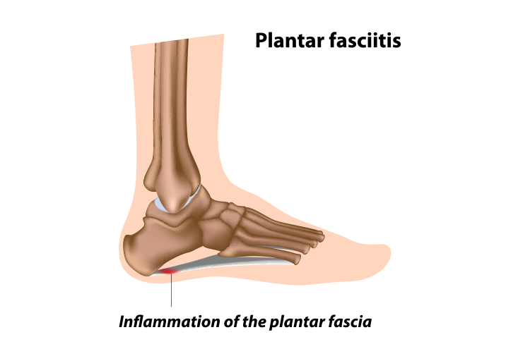 Detail Kerangka Kaki Manusia Nomer 33